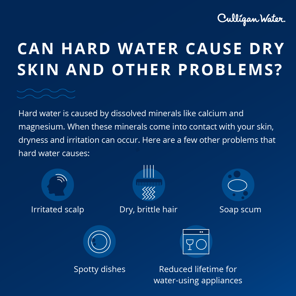 hard water and dry skin and other problems
